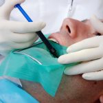 Root Canal Therapy: Unwinding The Benefits